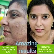 WhatsApp Image 2025-04-27 at 10.45.10_a44281ef